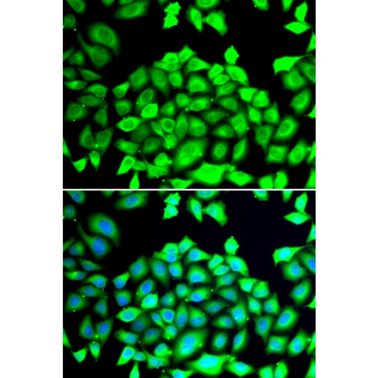 Immunofluorescence - Anti-CLCN7 Antibody (A12422) - Antibodies.com