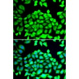 Immunofluorescence - Anti-CLCN7 Antibody (A12422) - Antibodies.com