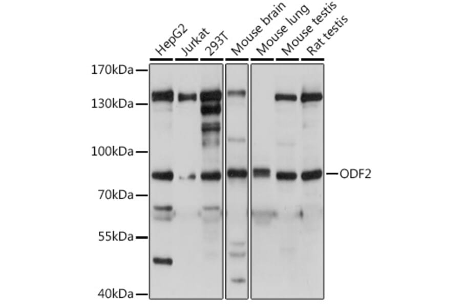 Western Blot - Anti-Cenexin1/ODF2 Antibody (A92471) - Antibodies.com