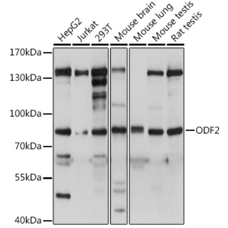 Western Blot - Anti-Cenexin1/ODF2 Antibody (A92471) - Antibodies.com
