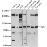 Western Blot - Anti-Cenexin1/ODF2 Antibody (A92471) - Antibodies.com