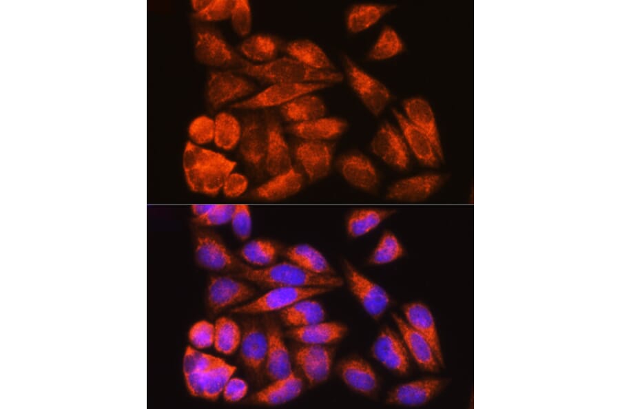 Immunofluorescence - Anti-Cenexin1/ODF2 Antibody (A92471) - Antibodies.com