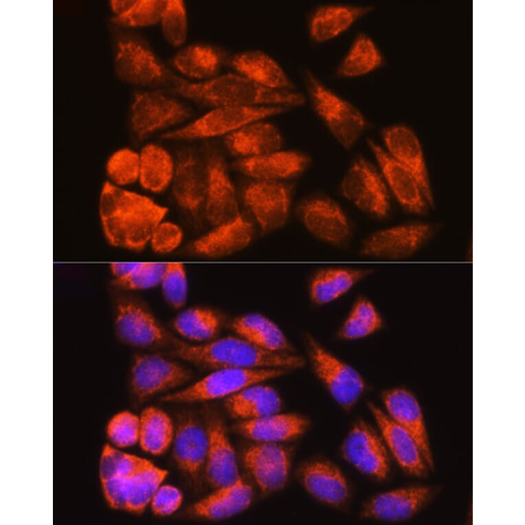 Immunofluorescence - Anti-Cenexin1/ODF2 Antibody (A92471) - Antibodies.com