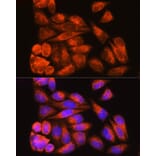 Immunofluorescence - Anti-Cenexin1/ODF2 Antibody (A92471) - Antibodies.com