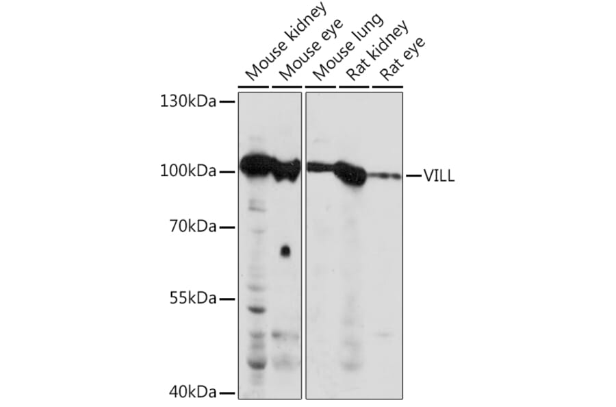 Western Blot - Anti-VILL Antibody (A92473) - Antibodies.com