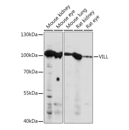 Western Blot - Anti-VILL Antibody (A92473) - Antibodies.com