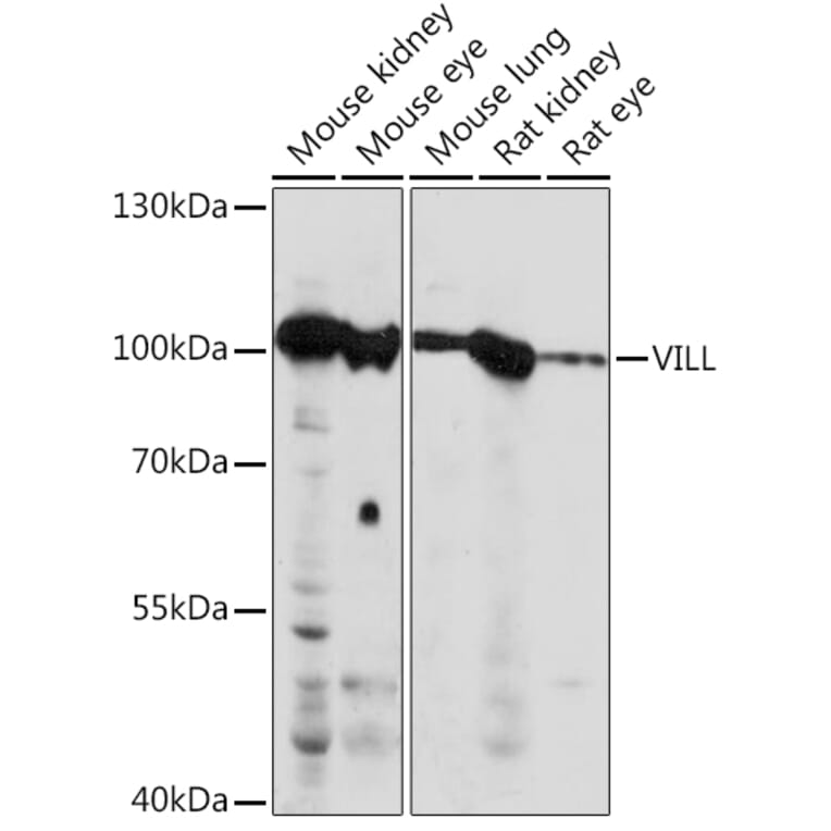 Western Blot - Anti-VILL Antibody (A92473) - Antibodies.com