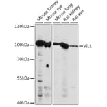 Western Blot - Anti-VILL Antibody (A92473) - Antibodies.com