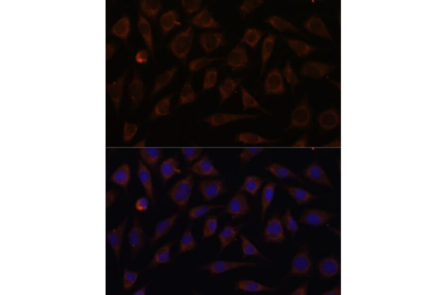 Immunofluorescence - Anti-VILL Antibody (A92473) - Antibodies.com