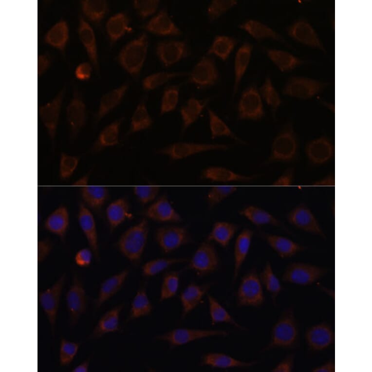 Immunofluorescence - Anti-VILL Antibody (A92473) - Antibodies.com