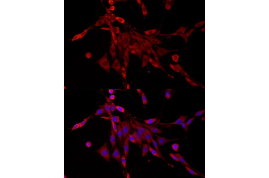 Immunofluorescence - Anti-PDE4C Antibody (A92474) - Antibodies.com