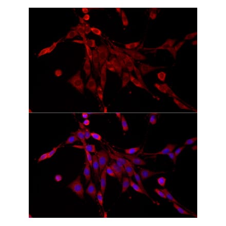 Immunofluorescence - Anti-PDE4C Antibody (A92474) - Antibodies.com