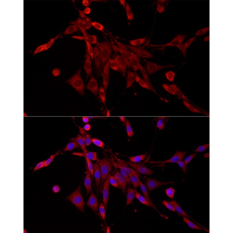 Immunofluorescence - Anti-PDE4C Antibody (A92474) - Antibodies.com
