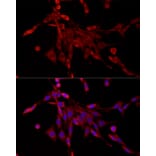 Immunofluorescence - Anti-PDE4C Antibody (A92474) - Antibodies.com