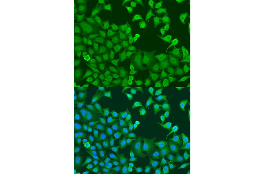 Immunofluorescence - Anti-STAT3 Antibody (A15729) - Antibodies.com