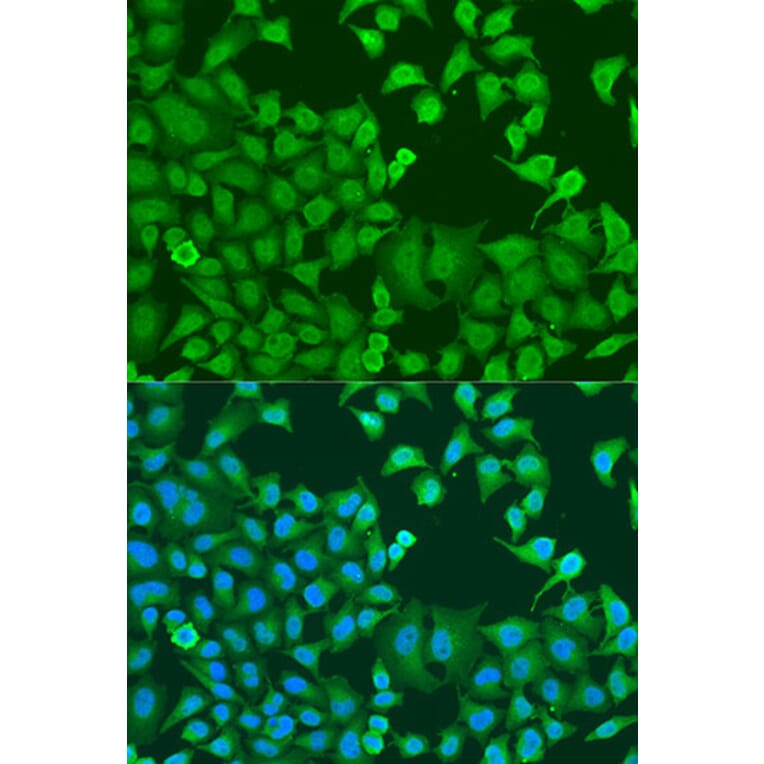Immunofluorescence - Anti-STAT3 Antibody (A15729) - Antibodies.com