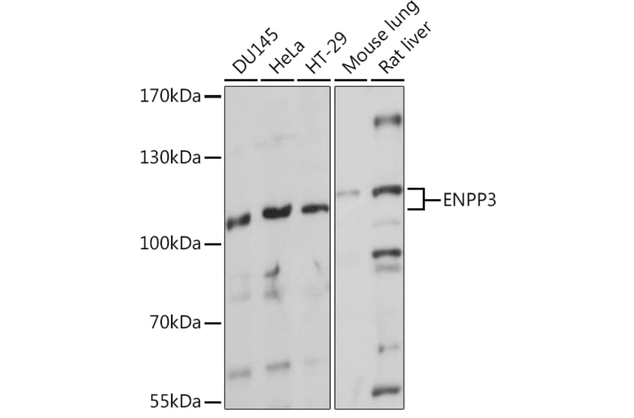 Western Blot - Anti-ENPP3/B10 Antibody (A92477) - Antibodies.com