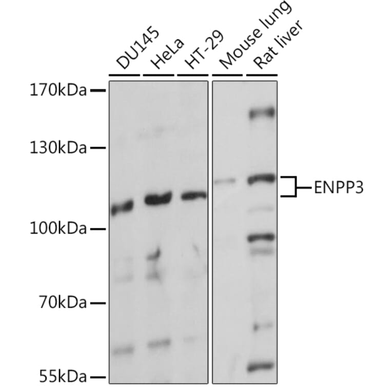 Western Blot - Anti-ENPP3/B10 Antibody (A92477) - Antibodies.com