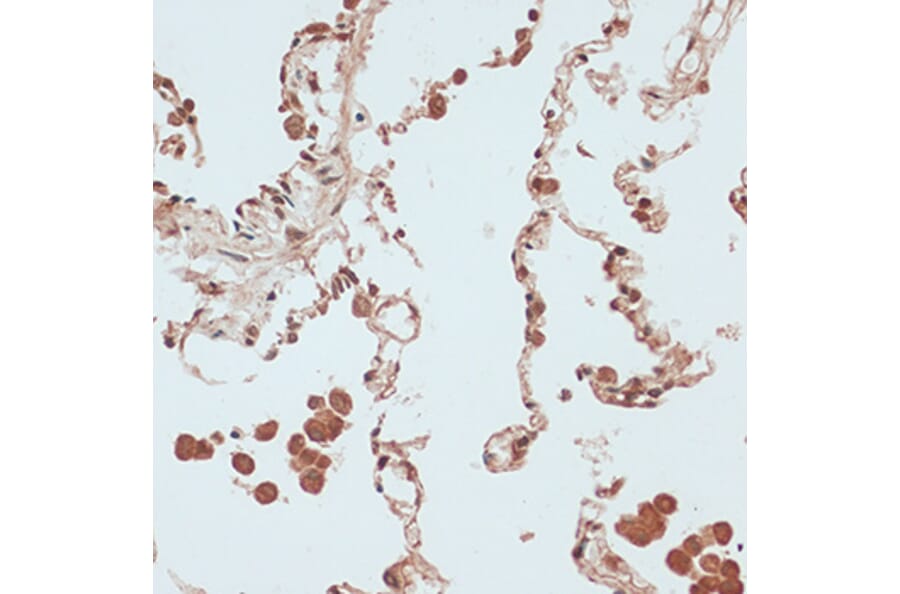Immunohistochemistry - Anti-RB1 Antibody (A14775) - Antibodies.com