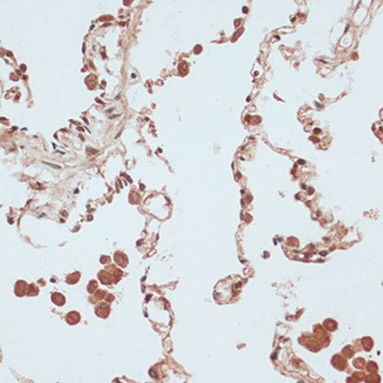 Immunohistochemistry - Anti-RB1 Antibody (A14775) - Antibodies.com