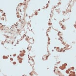 Immunohistochemistry - Anti-RB1 Antibody (A14775) - Antibodies.com
