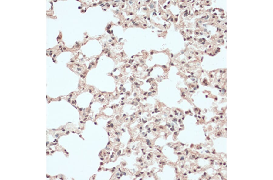 Immunohistochemistry - Anti-RB1 Antibody (A14775) - Antibodies.com