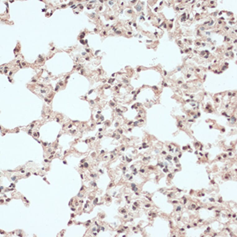 Immunohistochemistry - Anti-RB1 Antibody (A14775) - Antibodies.com