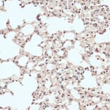 Immunohistochemistry - Anti-RB1 Antibody (A14775) - Antibodies.com
