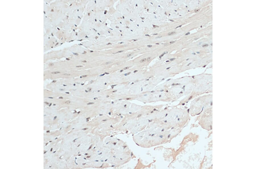 Immunohistochemistry - Anti-RB1 Antibody (A14775) - Antibodies.com