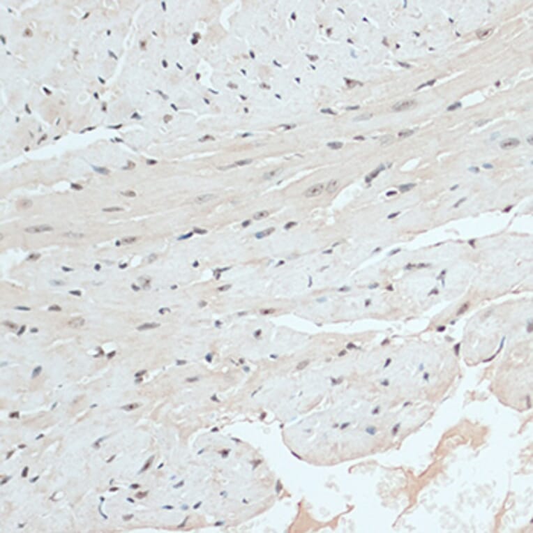 Immunohistochemistry - Anti-RB1 Antibody (A14775) - Antibodies.com