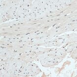 Immunohistochemistry - Anti-RB1 Antibody (A14775) - Antibodies.com