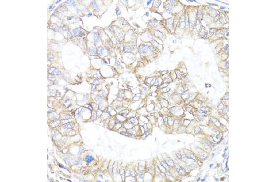 Immunohistochemistry - Anti-ATP1B1 Antibody (A13950) - Antibodies.com