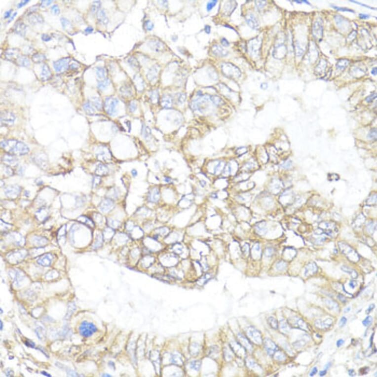 Immunohistochemistry - Anti-ATP1B1 Antibody (A13950) - Antibodies.com