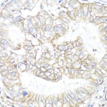 Immunohistochemistry - Anti-ATP1B1 Antibody (A13950) - Antibodies.com