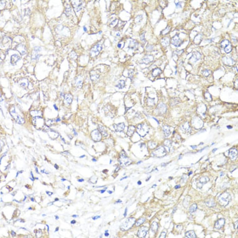 Immunohistochemistry - Anti-ATP1B1 Antibody (A13950) - Antibodies.com