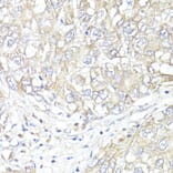 Immunohistochemistry - Anti-ATP1B1 Antibody (A13950) - Antibodies.com
