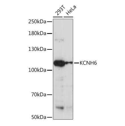 Western Blot - Anti-ERG2 Antibody (A92483) - Antibodies.com