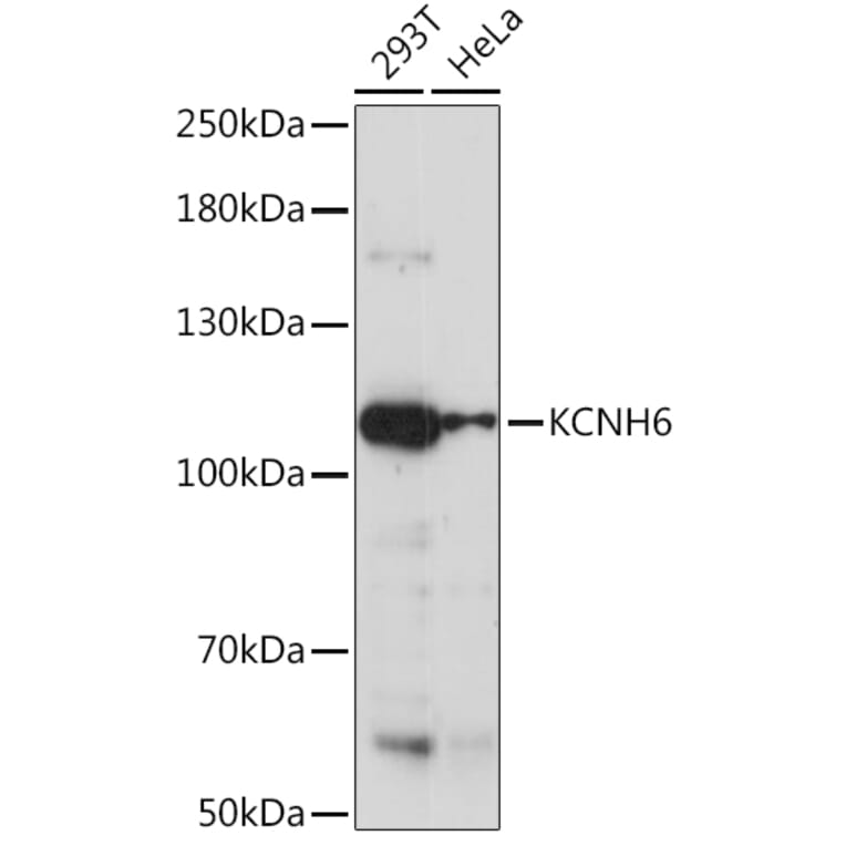 Western Blot - Anti-ERG2 Antibody (A92483) - Antibodies.com