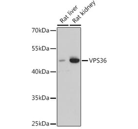 Western Blot - Anti-VPS36 Antibody (A92484) - Antibodies.com