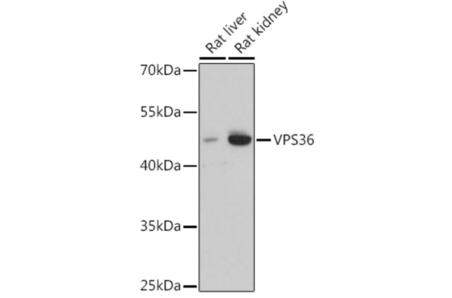 Western Blot - Anti-VPS36 Antibody (A92484) - Antibodies.com