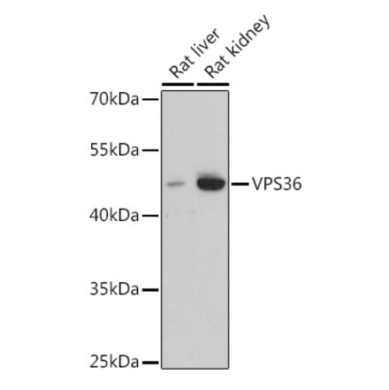 Western Blot - Anti-VPS36 Antibody (A92484) - Antibodies.com