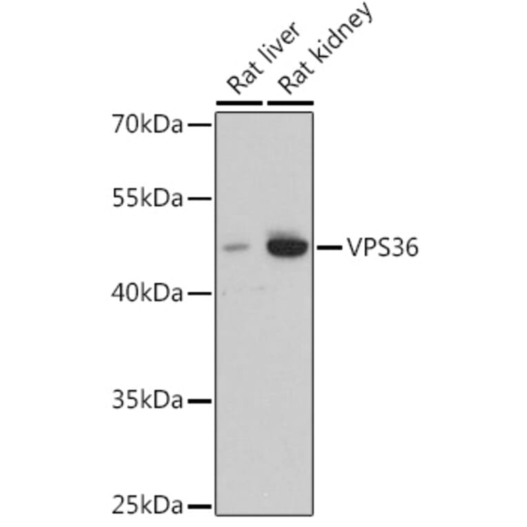 Western Blot - Anti-VPS36 Antibody (A92484) - Antibodies.com