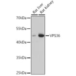 Western Blot - Anti-VPS36 Antibody (A92484) - Antibodies.com