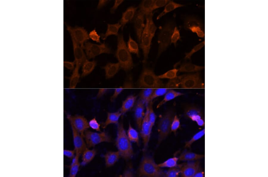 Immunofluorescence - Anti-VPS36 Antibody (A92484) - Antibodies.com