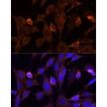 Immunofluorescence - Anti-VPS36 Antibody (A92484) - Antibodies.com