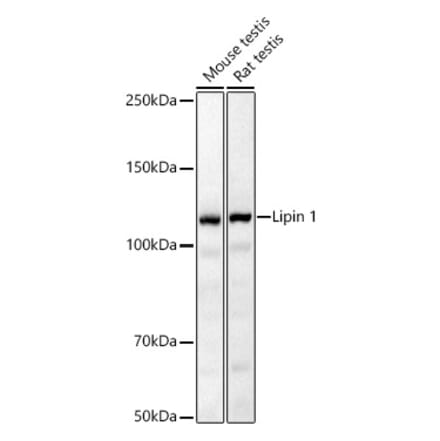 Western Blot - Anti-Lipin 1 Antibody (A92490) - Antibodies.com