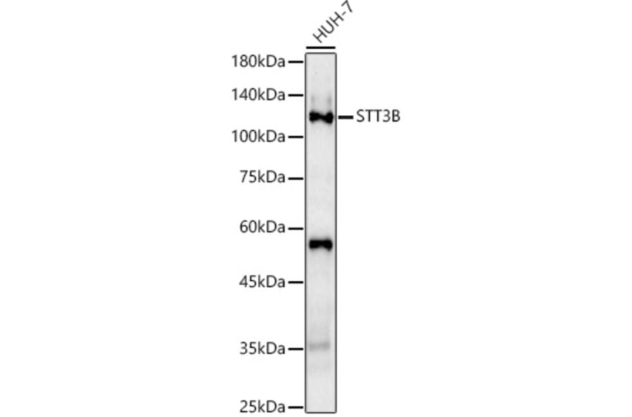 Western Blot - Anti-STT3B Antibody (A92492) - Antibodies.com