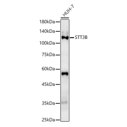 Western Blot - Anti-STT3B Antibody (A92492) - Antibodies.com