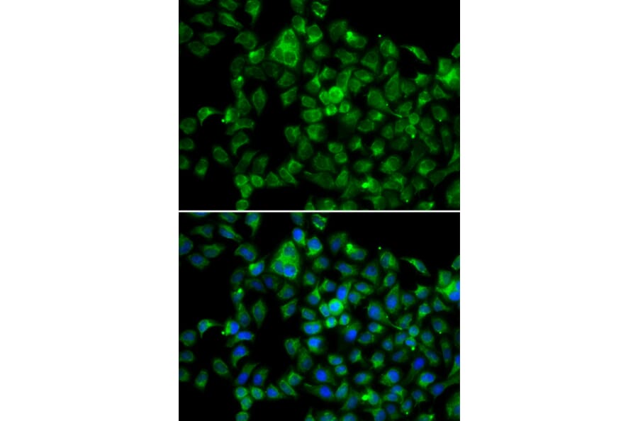 Immunofluorescence - Anti-NAT8B Antibody (A13428) - Antibodies.com