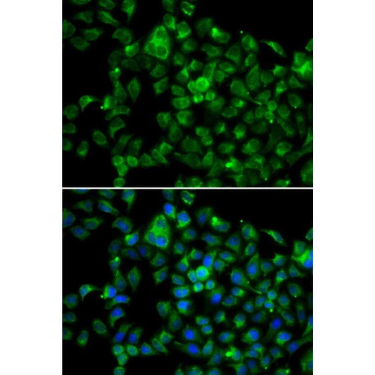 Immunofluorescence - Anti-NAT8B Antibody (A13428) - Antibodies.com